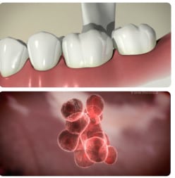 dental lab educational videos